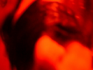 23 DYSPNEA 003