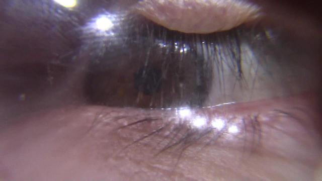 37 DR NEGAZIONE 010